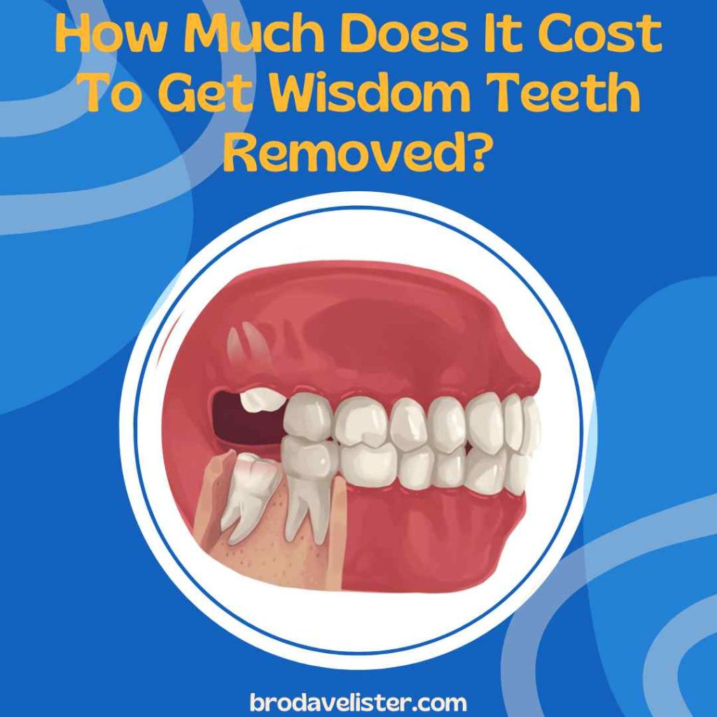 How Much Does It Cost To Get Wisdom Teeth Removed?