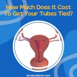 How Much Does It Cost To Get Your Tubes Tied?